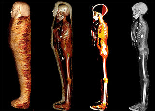 Radiologists Use CT Scans to ‘Digitally Unwrap’ Egypt’s Mummified ‘Golden Boy’